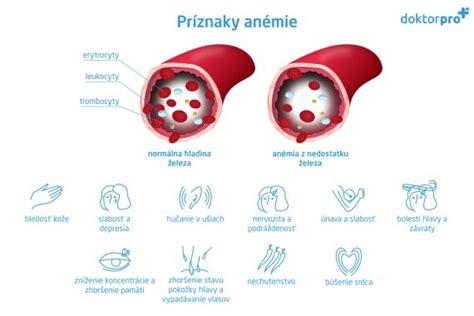 Infografika o virih železa v hrani in njegovi absorpciji