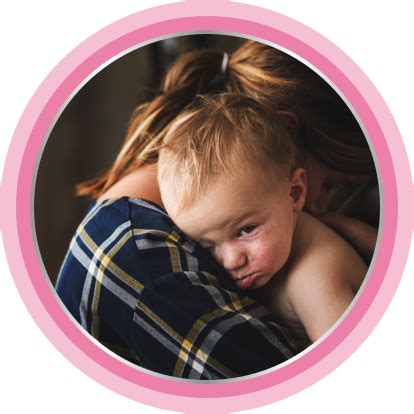 Ilustracija otroka z ekcemom