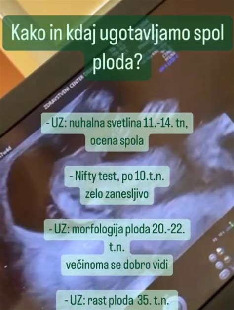 Simbolična upodobitev ultrazvočnega pregleda ploda