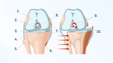 Ilustracija otroka z oteklim kolenom