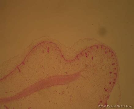 Diagram prikazuje ovoje ploda in plodovnico