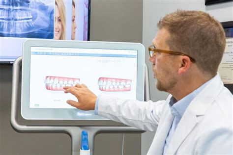 Shema premikanja zob med ortodontsko terapijo