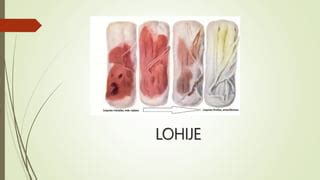 Ilustracija poporodnega izcedka (lohije)