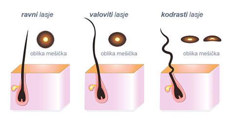 Diagram lasnega mešička in procesa izpadanja las