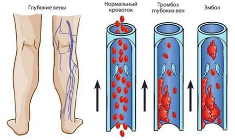 Diagram človeškega žilnega sistema z poudarkom na venah nog