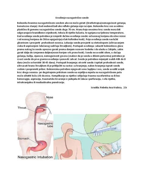 Diagram, ki prikazuje namestitev nazogastrične sonde