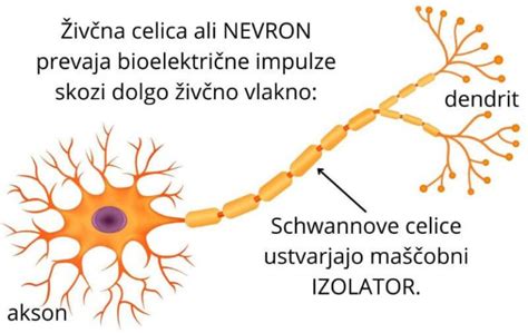 Diagram, ki prikazuje demielinizacijo pri multipli sklerozi