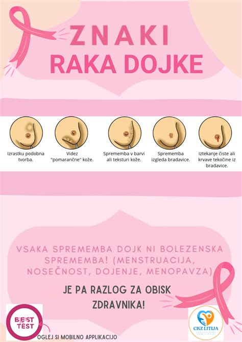 Ilustracija dojke z označenimi vnetnimi znaki