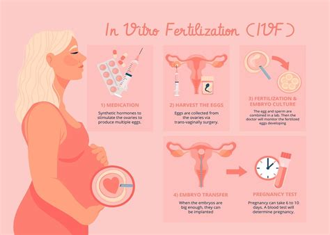 Ilustracija procesa IVF