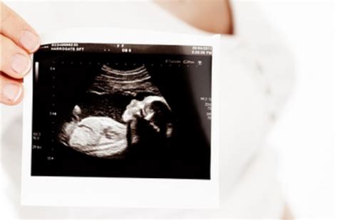 Ultrazvočni pregled morfologije ploda