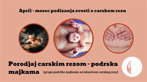 Ilustracija ženske med carskim rezom