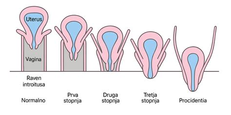 Diagram maternice in njenih vezi