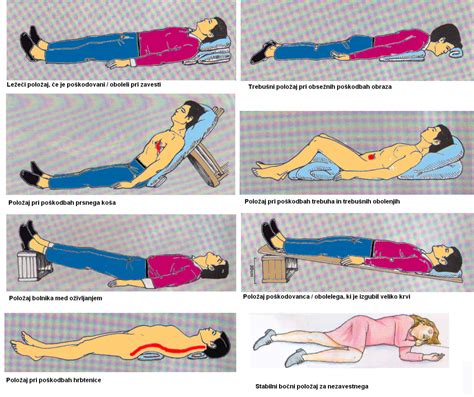 Ilustracija pravilnega odstranjevanja čebelinega žela