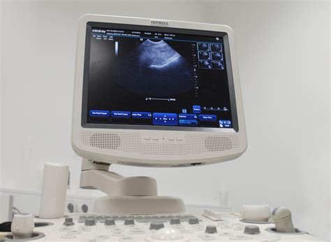 Ultrazvočni aparat med izvajanjem preiskave nosečnice
