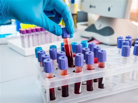 Analiza krvi v laboratoriju
