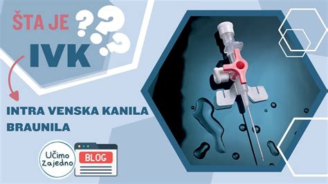 Venska kanila in britje presredka