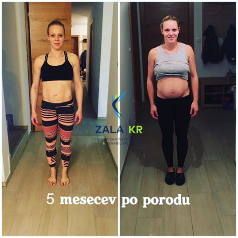 Žensko telo po porodu