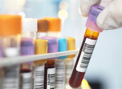 Diagram krvnih testov za ščitnico