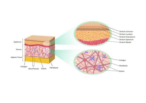 Diagram človeškega tkiva, ki prikazuje plasti kože in brazgotine