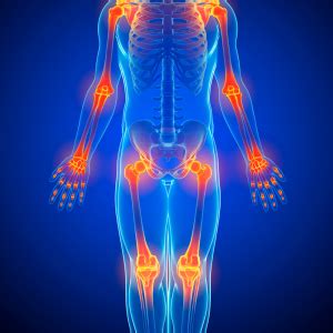 Ilustracija človeškega mišično-skeletnega sistema z označenimi pogostimi predeli bolečine