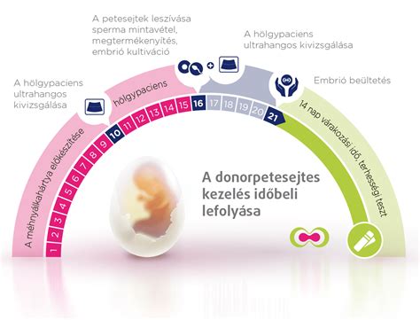 Infografika postopka IVF