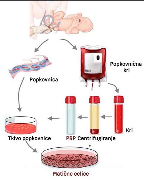 infografika o prednostih shranjevanja popkovnične krvi