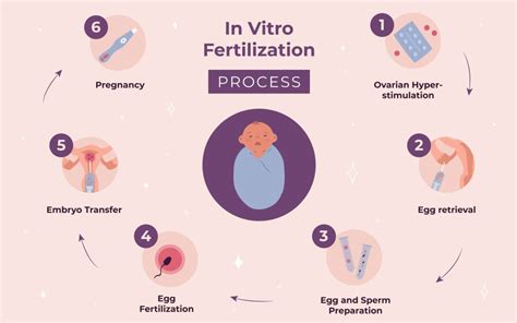 Ilustracija postopka IVF