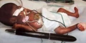 Dojenčica Amillia Taylor ob kemičnem svinčniku