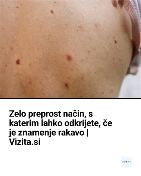 Diagram primerjave meritev temperature na različnih delih telesa