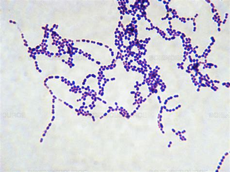 Prikaz bakterije Streptococcus pyogenes pod mikroskopom