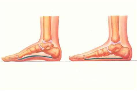 Ilustracija merjenja otroškega stopala stoje