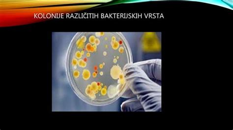 ilustracija bakterij na surovem piščancu
