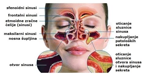 Anatomija nosu in paranazalnih sinusov