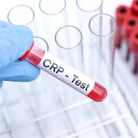 CRP test tube