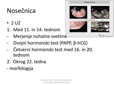 Diagram prikazuje časovnico nosečnosti z označenim obdobjem za merjenje nuhalne svetline