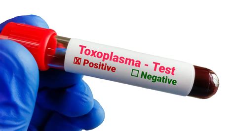 Preventiva toksoplazmoze