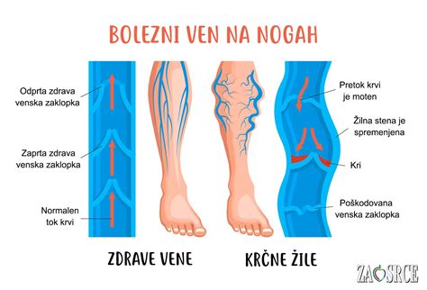 Diagram človeškega ožilja s poudarkom na spodnji votli veni