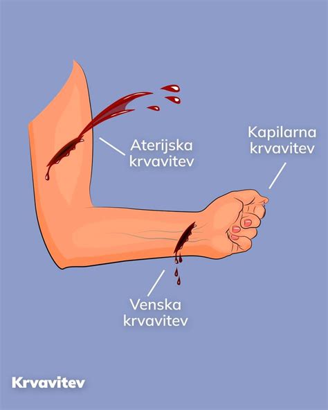 razlaga ugnezditvene krvavitve