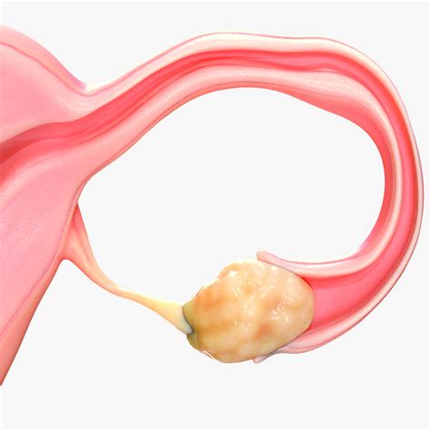 Ilustracija ženskega reproduktivnega sistema z označenimi jajčniki in folikli