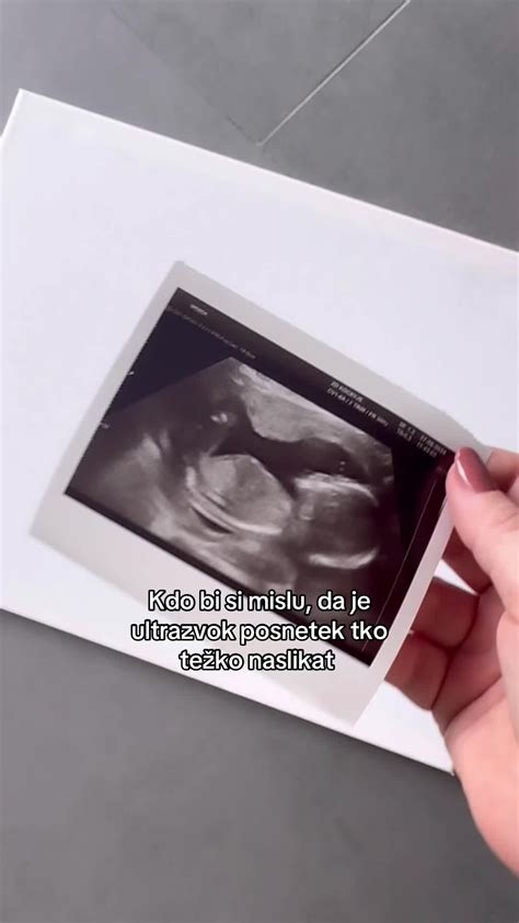 Ultrazvočni posnetek zgodnje nosečnosti z vidno gestacijsko vrečko