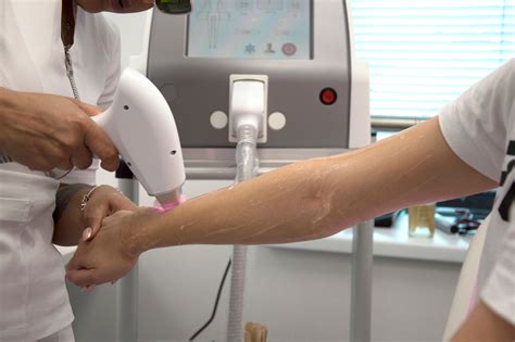 Ilustracija vraščene dlake, ki prodira v kožo