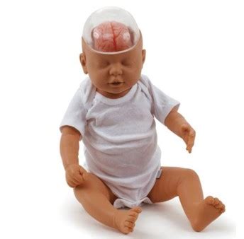 Natančen prikaz lobanje dojenčka z označenimi mečavami