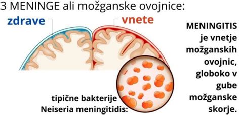 Diagram, ki prikazuje plasti lobanje in možganskih ovojnic