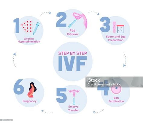 Diagram procesa oploditve in vitro (IVF)