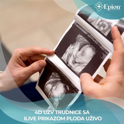 Prikaz položaja ploda v tretjem trimesečju