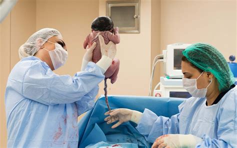 Priprava na carski rez