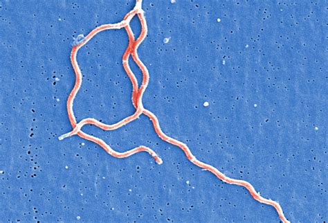 Mikroskopski posnetek bakterije Borrelia burgdorferi