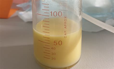 Prikaz rumenkastega kolostruma