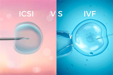 Diagram postopka IVF/ICSI