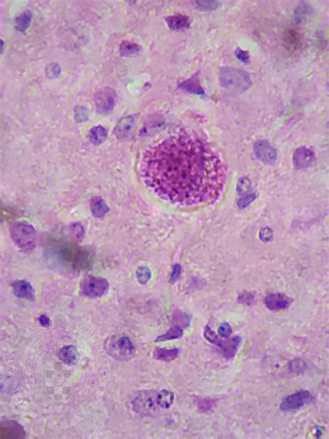 Prikaz mikroskopske slike parazita Toxoplasma gondii